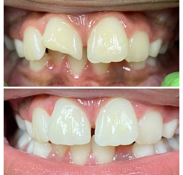 pediatric-dental-checkup.png