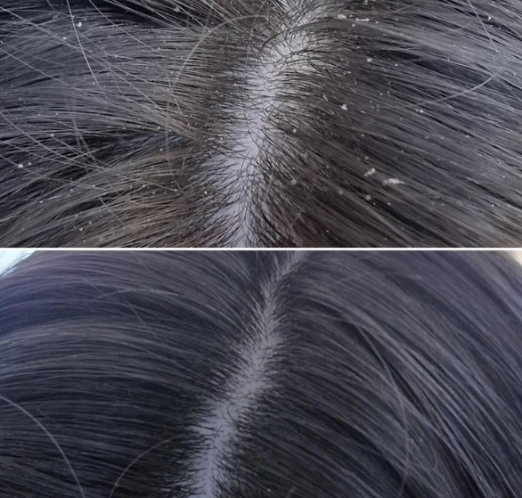 scalp-kid.png