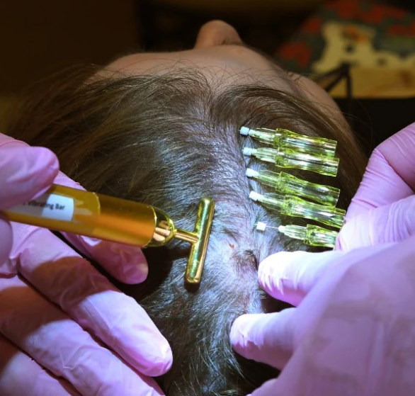 hair-thread-treatment.png