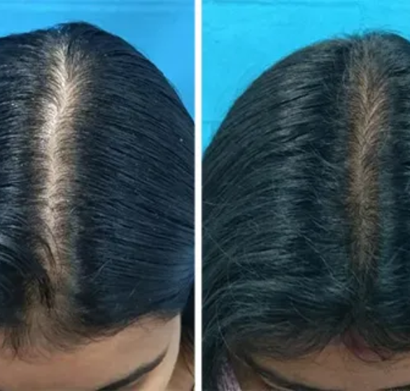 GFC-hair-treatment.png